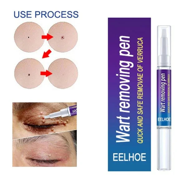 Warts Remover Original Cream